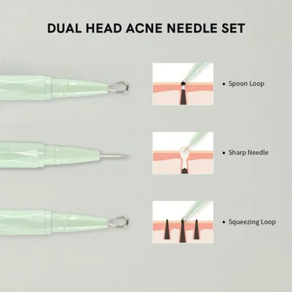 Byudy blackhead extractor – simple, safe, effective